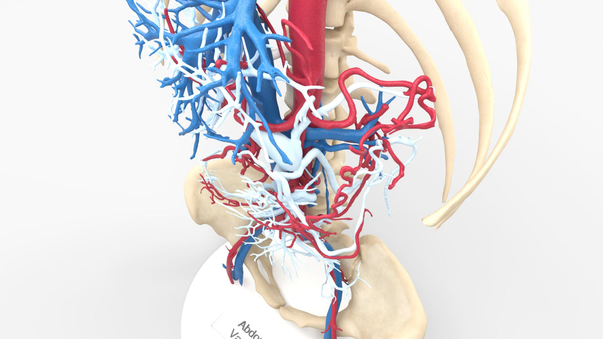 Abdominal Vasculature - Female, 53