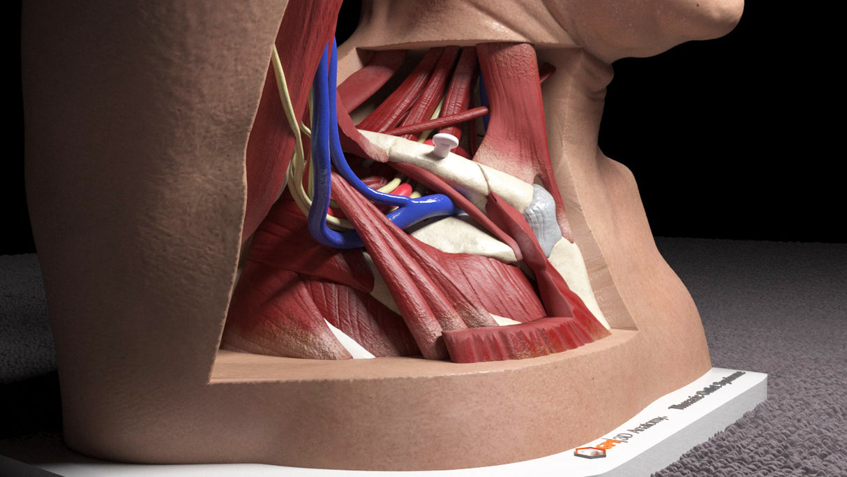 Thoracic Outlet Syndrome (TOS), Arm Up