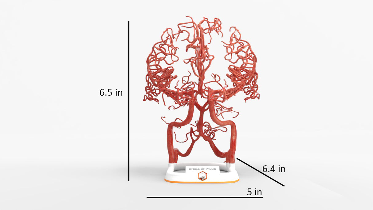 Circle of Willis (Circulus Arteriosus Cerebri) - Male, 54