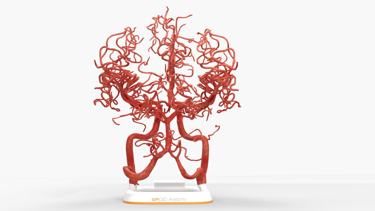 Circle of Willis (Circulus Arteriosus Cerebri) - Male, 54