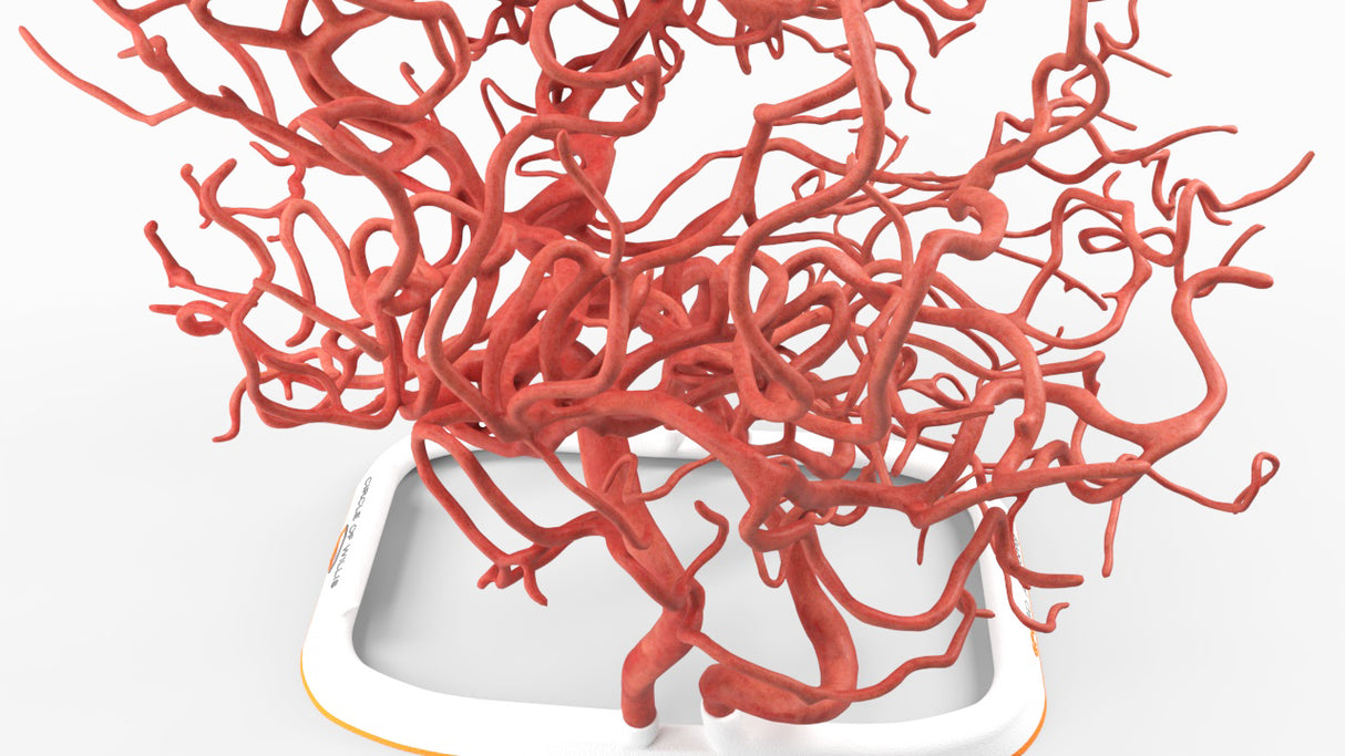 Circle of Willis (Circulus Arteriosus Cerebri) - Male, 54