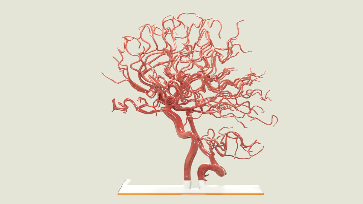 Circle of Willis (Circulus Arteriosus Cerebri)