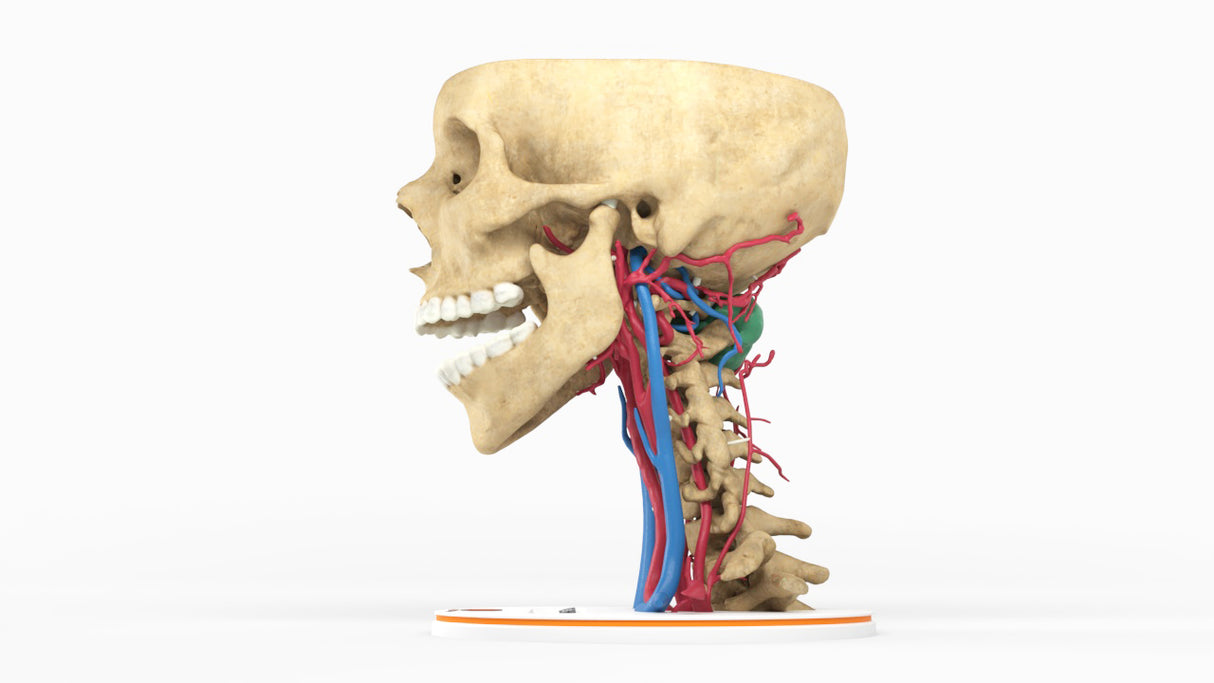 Opaque Cervical Spine Mass - Female, 19 Years