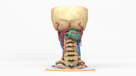 Opaque Cervical Spine Mass - Female, 19 Years