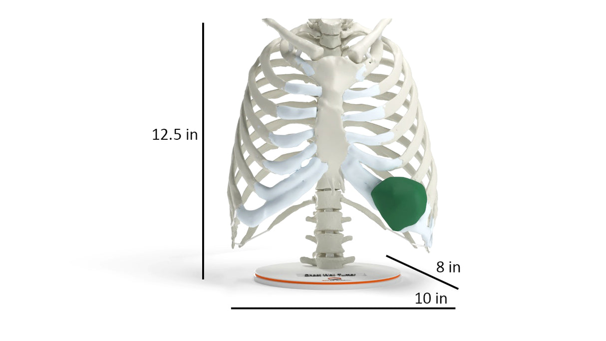 Chest Wall with Tumor