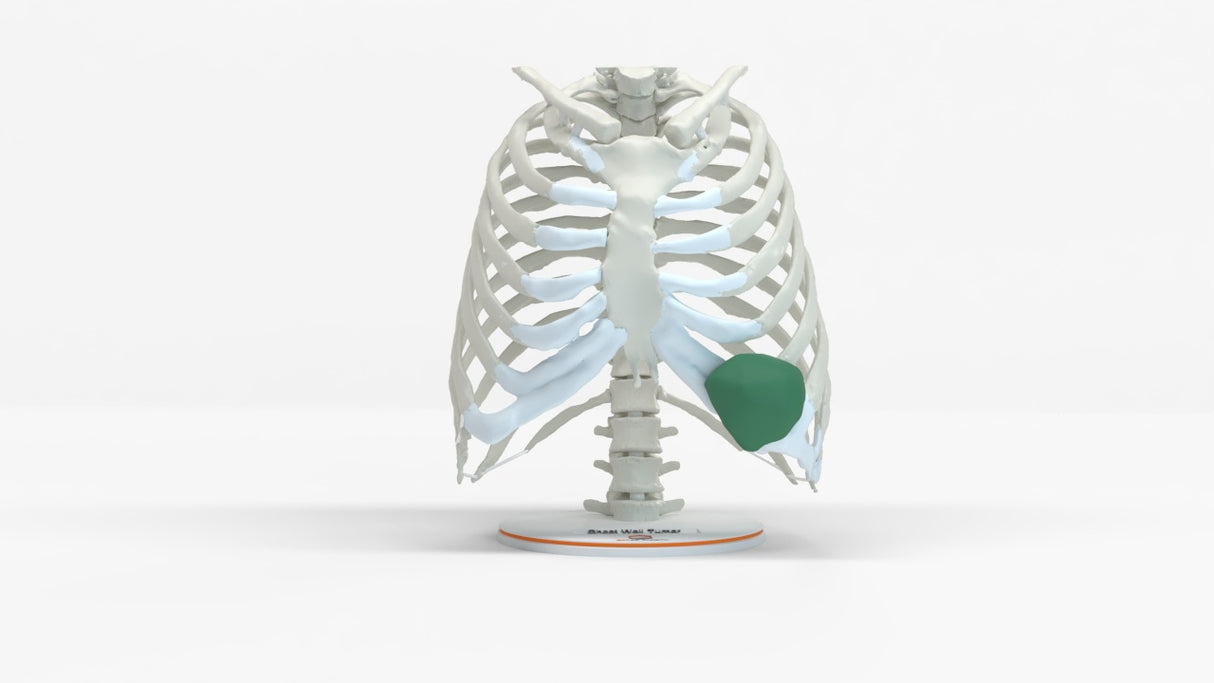 Chest Wall with Tumor