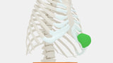 Chest Wall Tumor