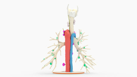 Tracheobronchial Tree With Lymph Nodes - Male, 28 Years