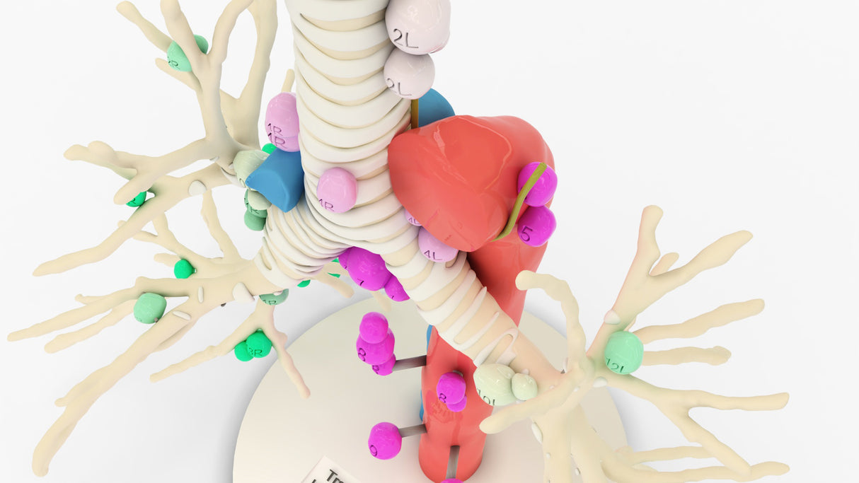 Tracheobronchial Tree With Lymph Nodes - Male, 28 Years
