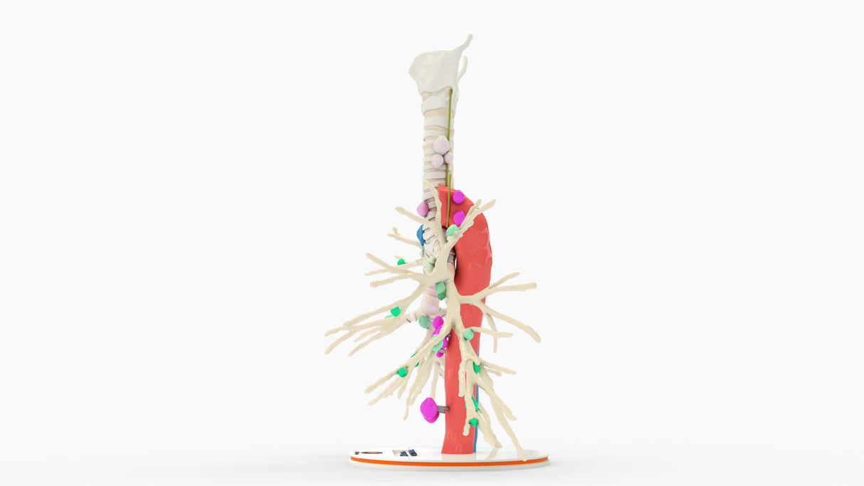 Tracheobronchial Tree With Lymph Nodes - Male, 28 Years