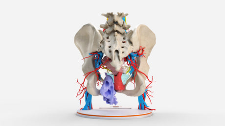 Pelvic Hernia – Female, 48 Years