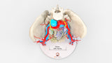 Pelvic Hernia – Female, 48 Years