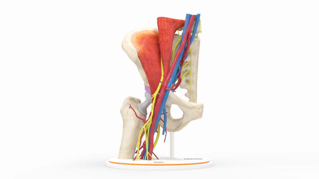 Iliopsoas Impingement