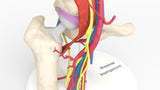 Iliopsoas Impingement