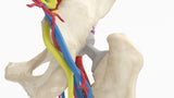 Iliopsoas Impingement