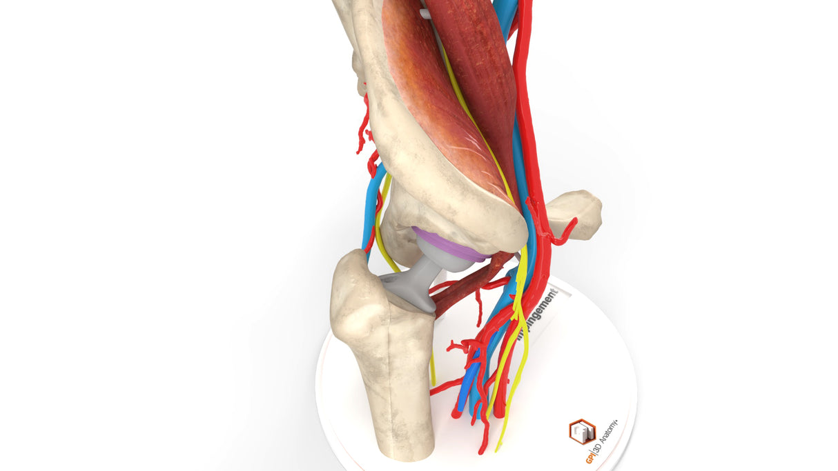 Iliopsoas Impingement