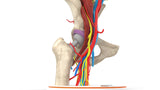 Iliopsoas Impingement