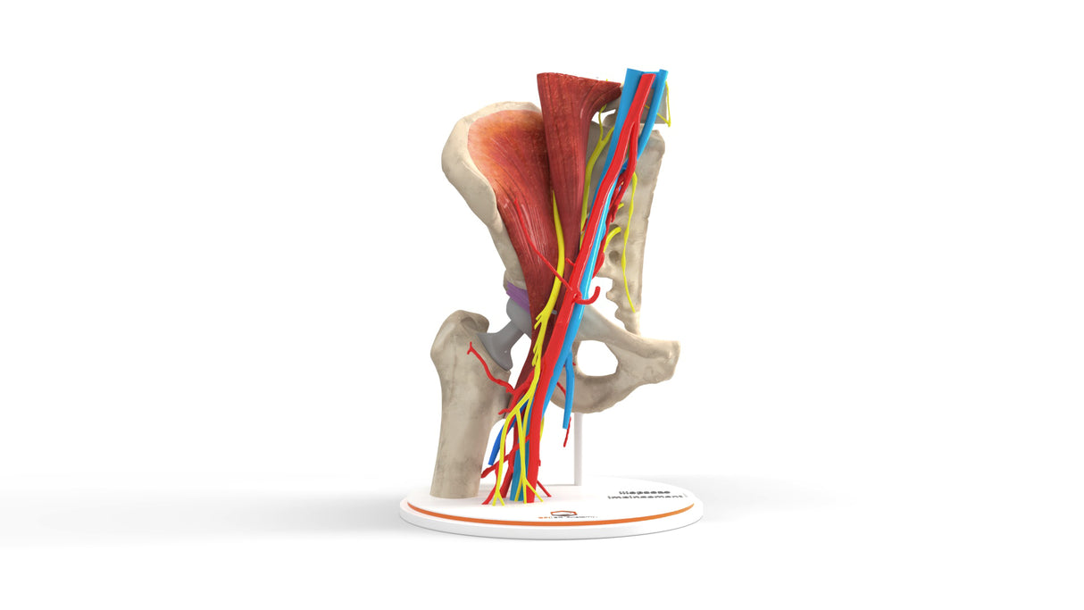 Iliopsoas Impingement