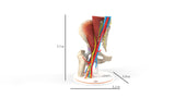 Iliopsoas Impingement