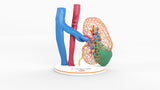 Lattice Left Kidney With Neoplasm - Male, 50