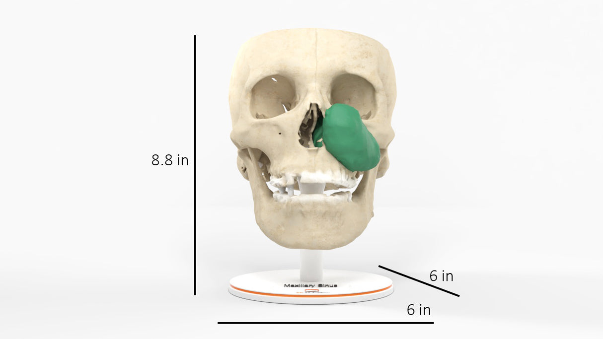 Maxillary Sinus Tumor