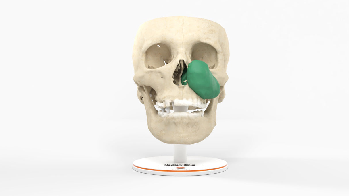 Maxillary Sinus Tumor