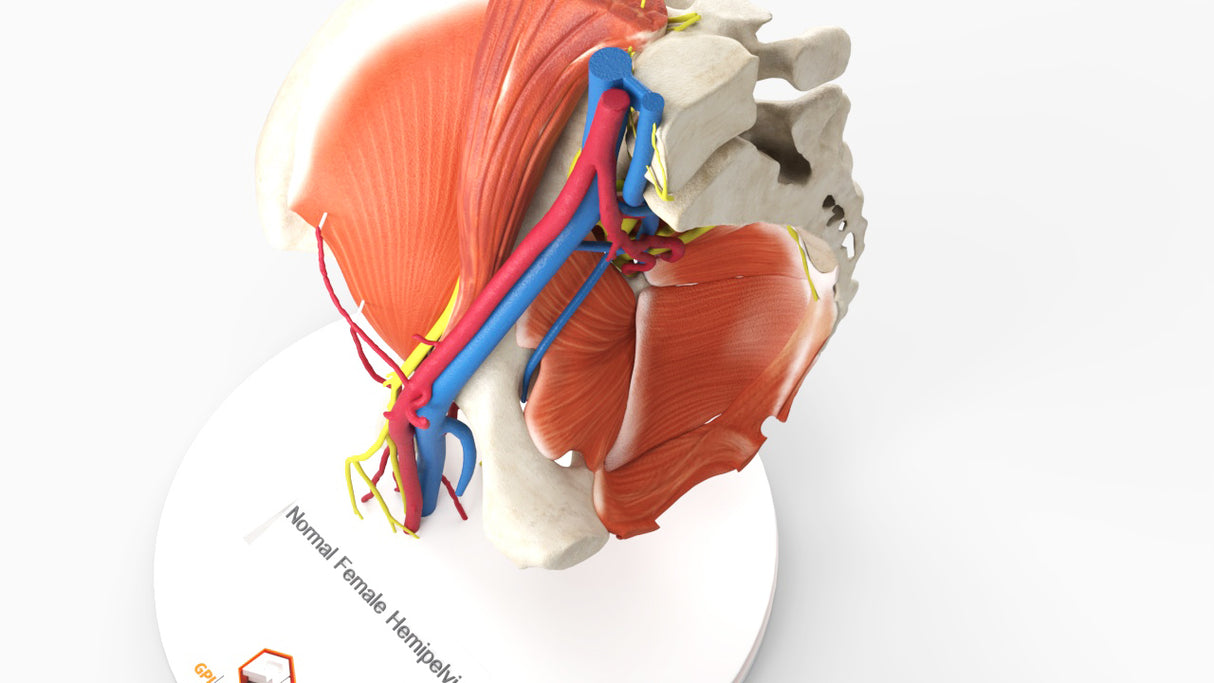 Normal Female Hemipelvis - Female, 53 Years