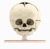 Infant Skull, Normal - Male, 8 Months