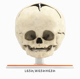 Infant Skull, Normal - Male, 8 Months