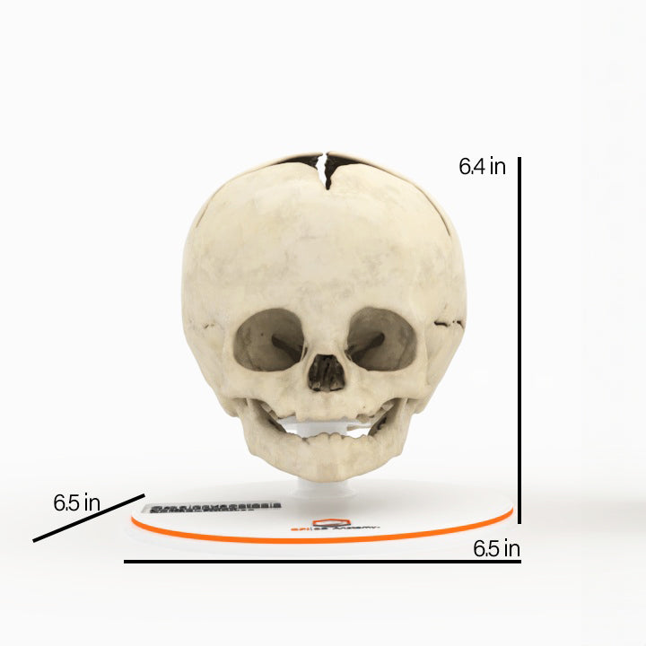 Infant Skull, Normal - Male, 8 Months