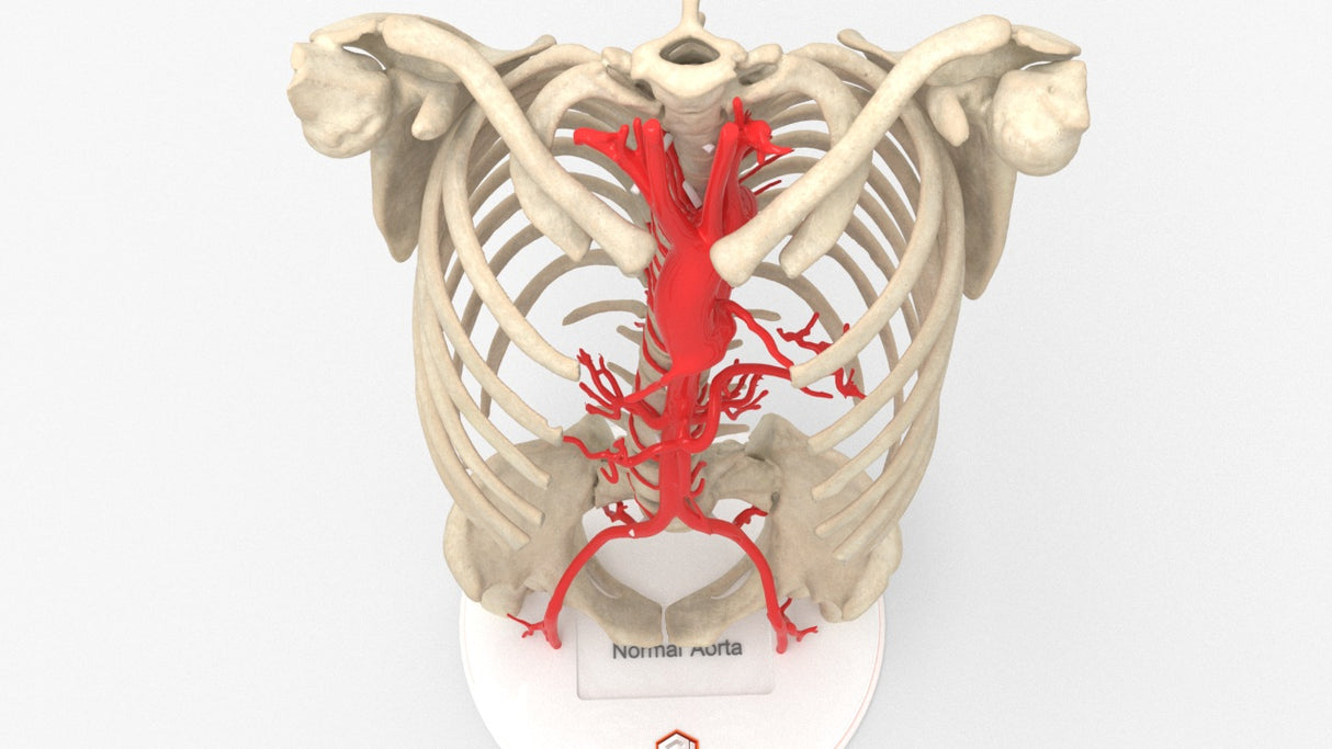 Normal Adult Aorta