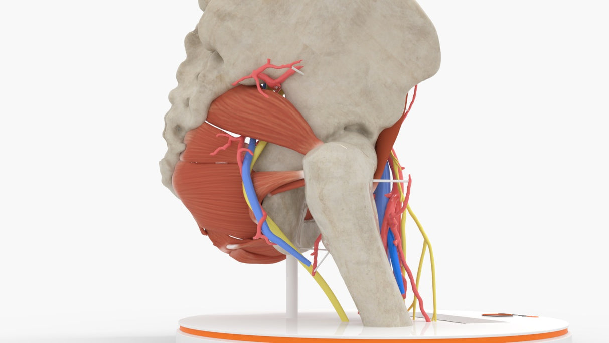 Normal Female Hemipelvis - Female, 53 Years