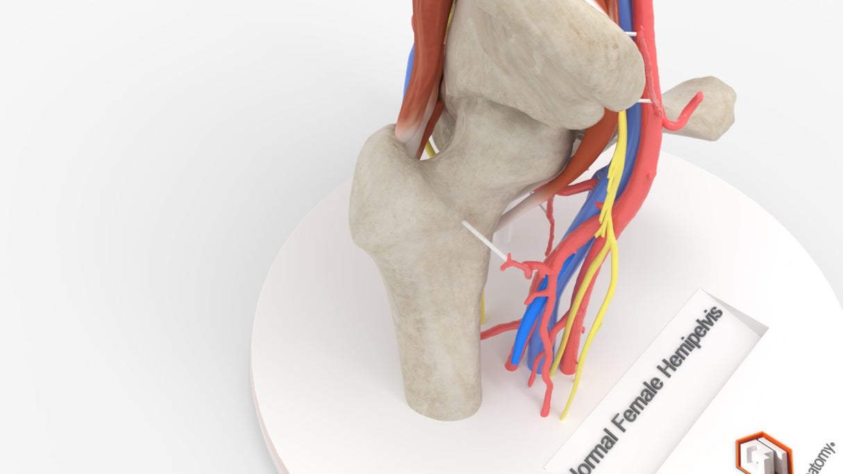 Normal Female Hemipelvis - Female, 53 Years