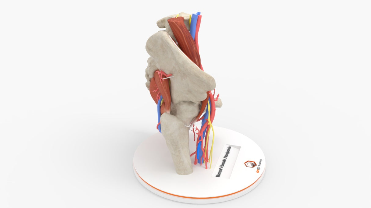 Normal Female Hemipelvis - Female, 53 Years