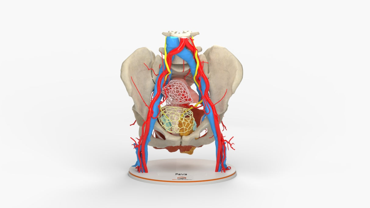 Pelvic Hernia – Female, 48 Years