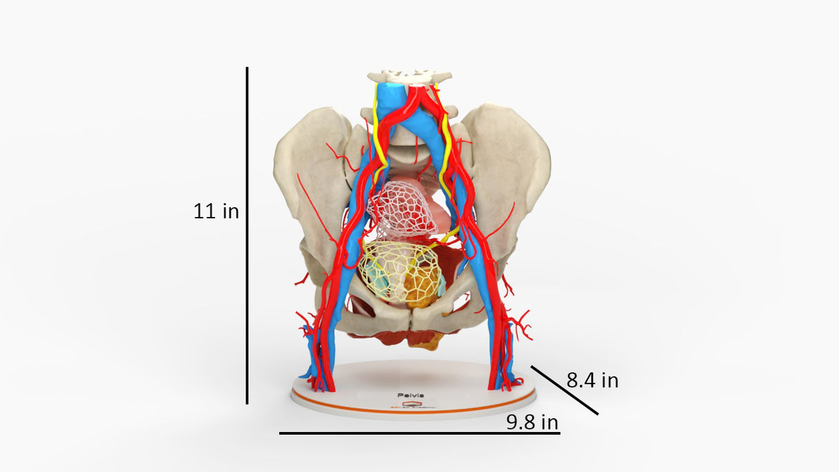 Pelvic Hernia – Female, 48 Years