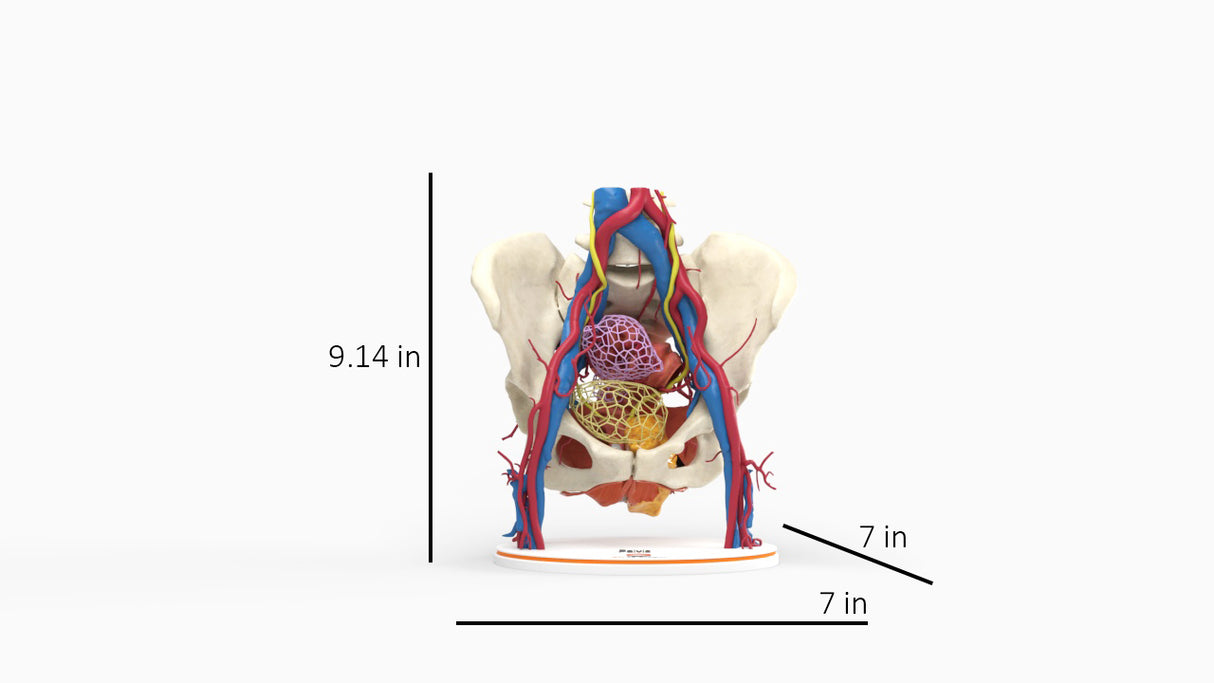 Pelvic Hernia – Female, 48 Years