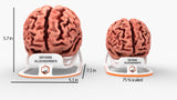 Adult Brain With Alzheimer’s Disease, Severe