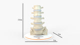 Spine With Bilateral Spondylolysis (Pars Defect), Grade 1 – Male, 27 years