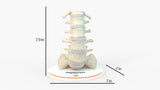 Spine With Spondylolysis (Pars Defect), Grade 4 – Female, 16 Years