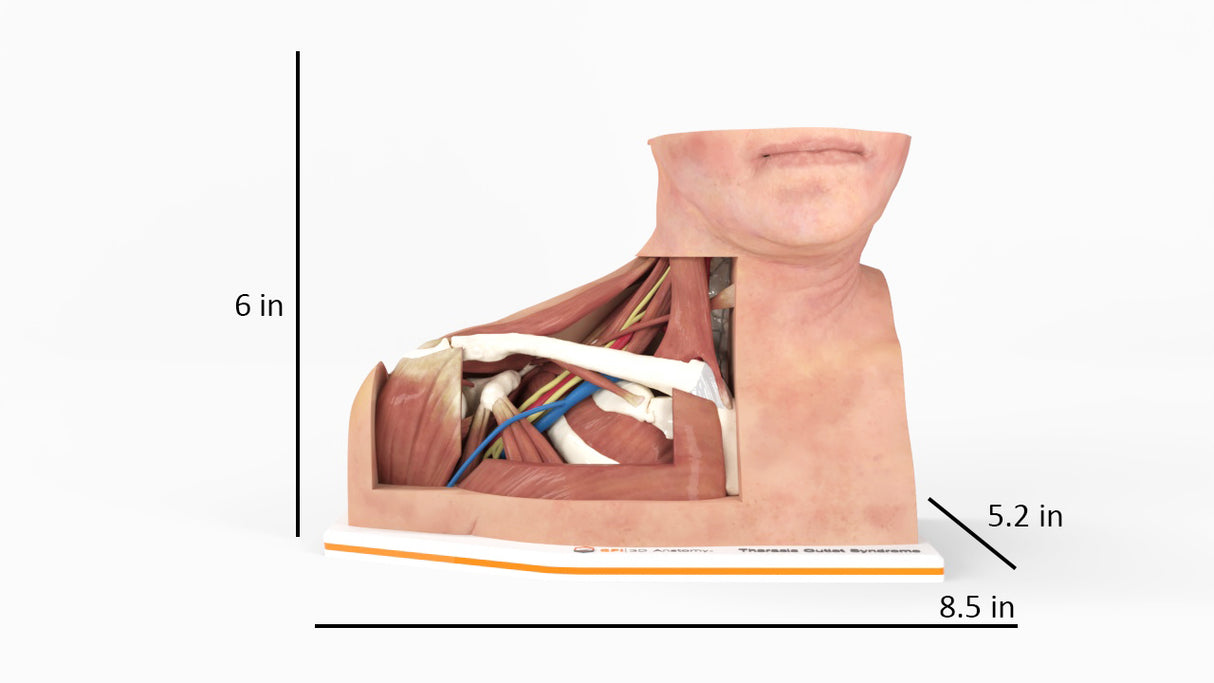 Thoracic Outlet Syndrome (TOS), Arm Down