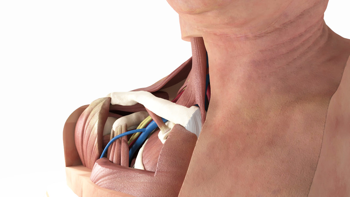 Thoracic Outlet Syndrome (TOS), Arm Down