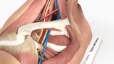 Thoracic Outlet Syndrome (TOS), Arm Down