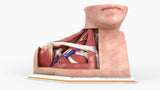 Thoracic Outlet Syndrome (TOS), Arm Down