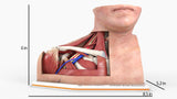 Thoracic Outlet Syndrome (TOS), Arm Down