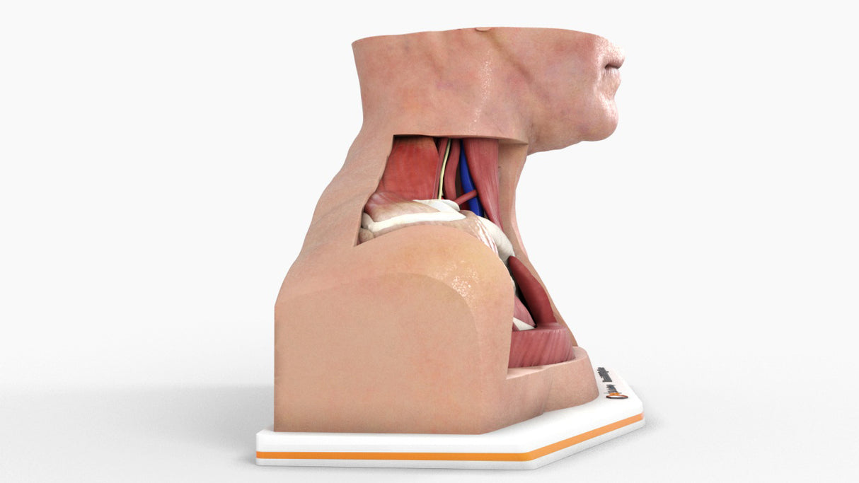 Thoracic Outlet Syndrome (TOS), Arm Down