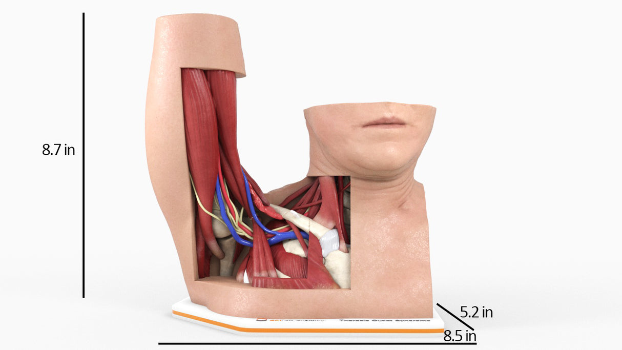 Thoracic Outlet Syndrome (TOS), Arm Up