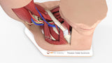 Thoracic Outlet Syndrome (TOS), Arm Up