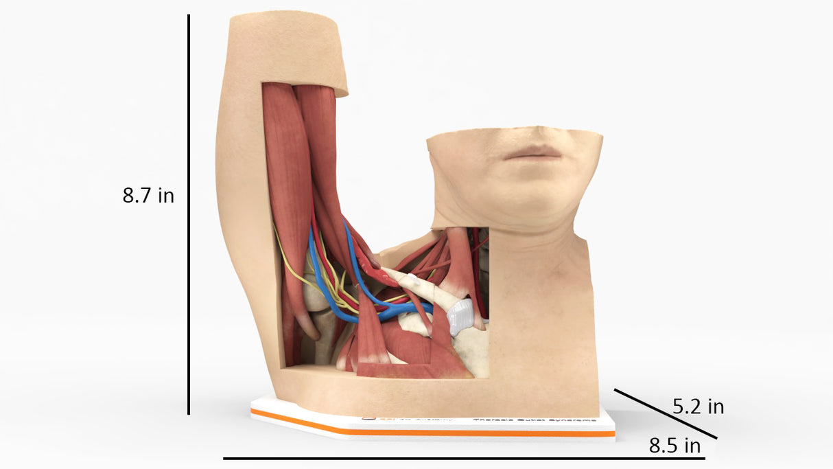 Thoracic Outlet Syndrome (TOS), Arm Up