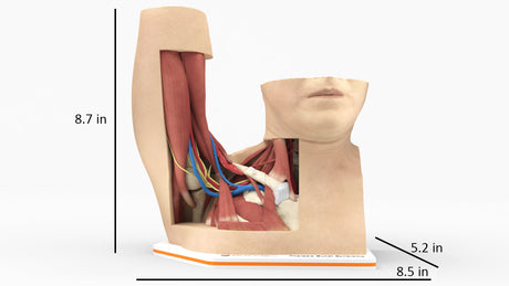 Thoracic Outlet Syndrome (TOS), Arm Up